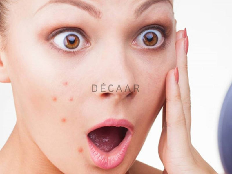 Không tự ý nặn mụn sưng viêm tại nhà